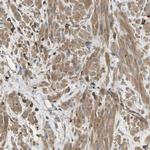 Talin 1 Antibody in Immunohistochemistry (Paraffin) (IHC (P))