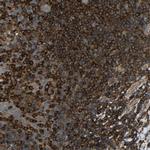 Talin 1 Antibody in Immunohistochemistry (Paraffin) (IHC (P))