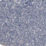 Progesterone Receptor Antibody in Immunohistochemistry (Paraffin) (IHC (P))