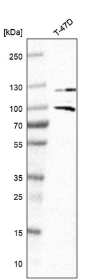 Progesterone Receptor Antibody in Western Blot (WB)