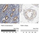 Progesterone Receptor Antibody