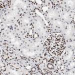 MEF2D Antibody in Immunohistochemistry (Paraffin) (IHC (P))