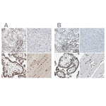 MEF2D Antibody in Immunohistochemistry (Paraffin) (IHC (P))