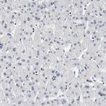 MEF2D Antibody in Immunohistochemistry (Paraffin) (IHC (P))