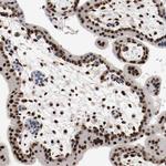 MEF2D Antibody in Immunohistochemistry (Paraffin) (IHC (P))