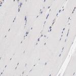 IFITM1 Antibody in Immunohistochemistry (Paraffin) (IHC (P))