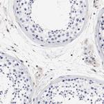 IFITM1 Antibody in Immunohistochemistry (Paraffin) (IHC (P))