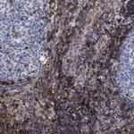 IFITM1 Antibody in Immunohistochemistry (Paraffin) (IHC (P))