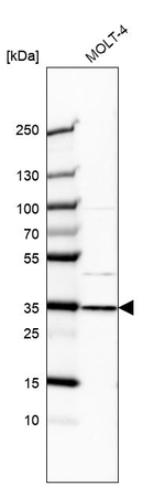 GTF2E2 Antibody in Western Blot (WB)