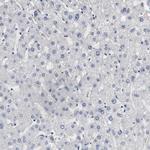 MCM6 Antibody in Immunohistochemistry (Paraffin) (IHC (P))