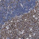 MCM6 Antibody in Immunohistochemistry (Paraffin) (IHC (P))