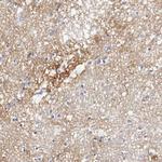Tenascin C Polyclonal Antibody