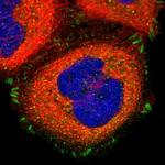 CD51 Polyclonal Antibody