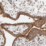 CD51 Antibody in Immunohistochemistry (Paraffin) (IHC (P))