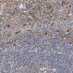 APRIL Polyclonal Antibody