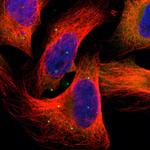 HGS Polyclonal Antibody