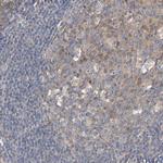 HGS Antibody in Immunohistochemistry (Paraffin) (IHC (P))