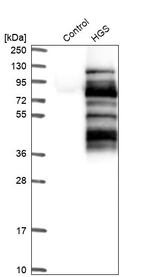 HGS Antibody in Western Blot (WB)