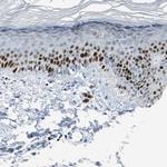 MCM4 Antibody in Immunohistochemistry (Paraffin) (IHC (P))