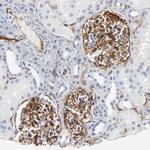 ICAM-1 Antibody in Immunohistochemistry (Paraffin) (IHC (P))