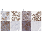 ICAM-1 Polyclonal Antibody