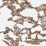 ICAM-1 Antibody in Immunohistochemistry (Paraffin) (IHC (P))
