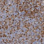ICAM-1 Antibody in Immunohistochemistry (Paraffin) (IHC (P))