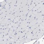 ICAM-1 Antibody in Immunohistochemistry (Paraffin) (IHC (P))