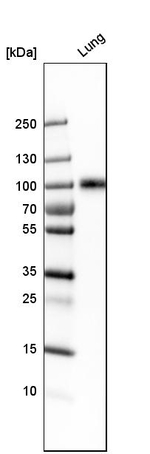 ICAM-1 Antibody in Western Blot (WB)