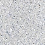 Cyclin T1 Antibody in Immunohistochemistry (Paraffin) (IHC (P))
