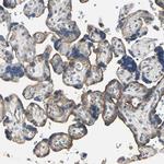 IRF3 Antibody in Immunohistochemistry (Paraffin) (IHC (P))