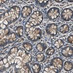 IRF3 Antibody in Immunohistochemistry (Paraffin) (IHC (P))