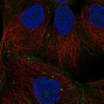 Desmoglein 2 Polyclonal Antibody