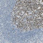 BCL6 Antibody in Immunohistochemistry (Paraffin) (IHC (P))