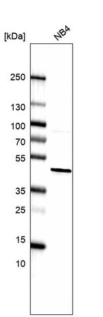 hnRNP D Antibody in Western Blot (WB)