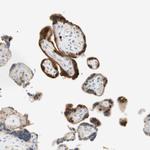 15-PGDH Antibody in Immunohistochemistry (Paraffin) (IHC (P))