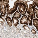 15-PGDH Polyclonal Antibody