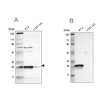 15-PGDH Antibody in Western Blot (WB)