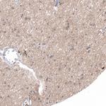 HTR1E Antibody in Immunohistochemistry (Paraffin) (IHC (P))