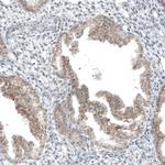 HTR1E Antibody in Immunohistochemistry (Paraffin) (IHC (P))