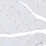 HTR1E Antibody in Immunohistochemistry (Paraffin) (IHC (P))