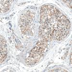 HTR1E Polyclonal Antibody