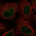 NUP62 Polyclonal Antibody