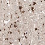 NUP62 Antibody in Immunohistochemistry (Paraffin) (IHC (P))