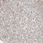 NUP62 Antibody in Immunohistochemistry (Paraffin) (IHC (P))