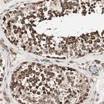 NUP62 Antibody in Immunohistochemistry (Paraffin) (IHC (P))