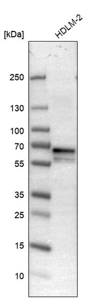 NUP62 Antibody in Western Blot (WB)