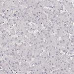 HNF4G Antibody in Immunohistochemistry (Paraffin) (IHC (P))