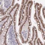 HNF4G Antibody in Immunohistochemistry (Paraffin) (IHC (P))