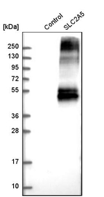 SLC2A5 Antibody in Western Blot (WB)